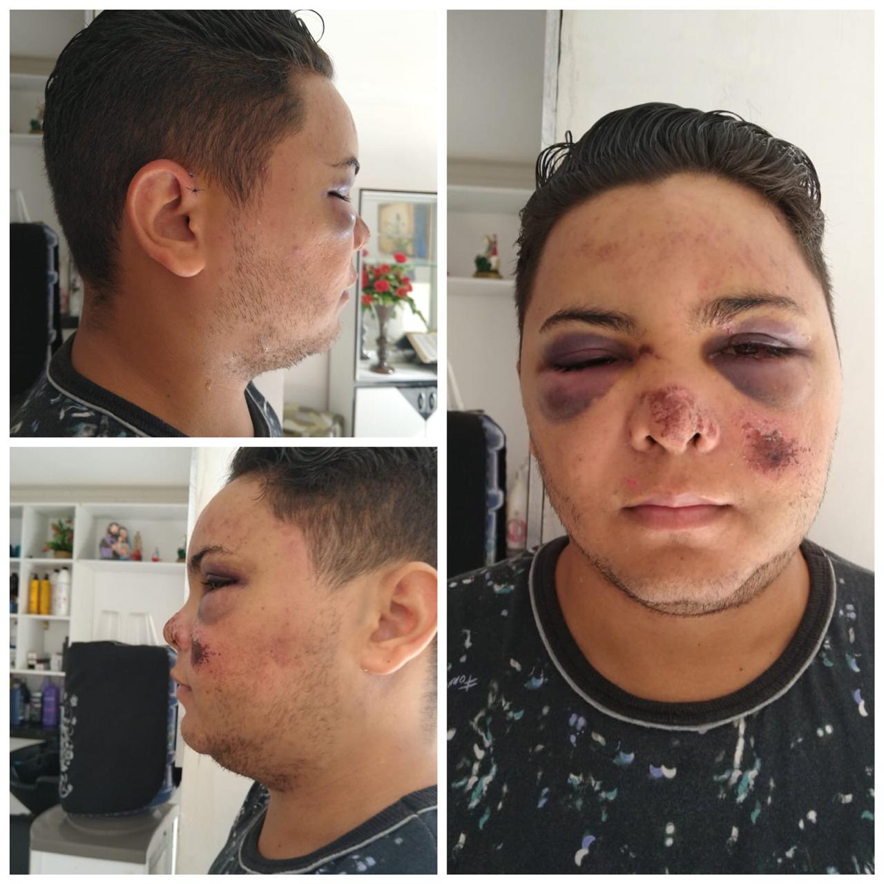 Polícia Civil conclui inquérito do caso do cabeleireiro agredido no parque de Exposições